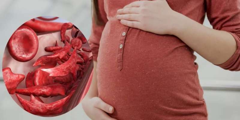 أعراض فقر الدم عند الحامل