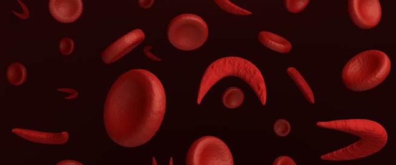 أعراض مرض فقر الدم المنجلي
