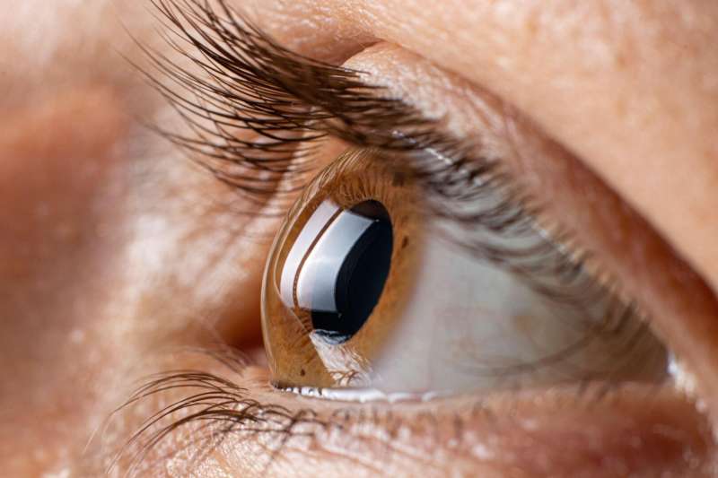 تعرف على أسباب وأعراض انفصال شبكية العين
