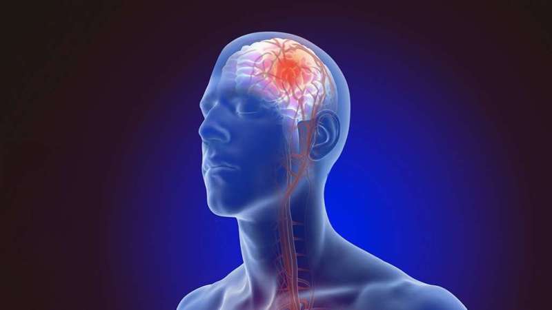 التحفيز العميق للدماغ يعطي أملا جديدا لمرضى السكتة الدماغية.. ماذا يعني ذلك؟