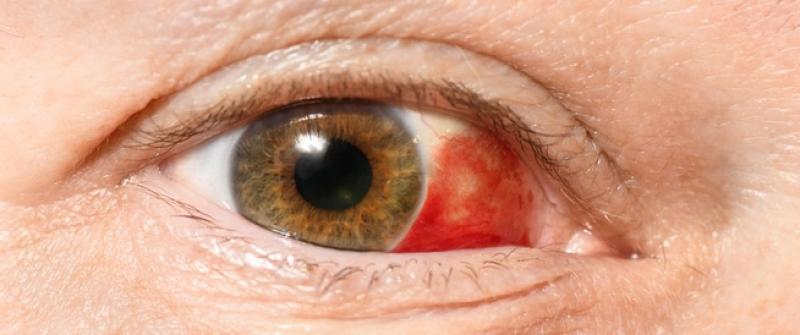 احذر.. ظهور العين الحمراء في الصور يشير لهذا المرض