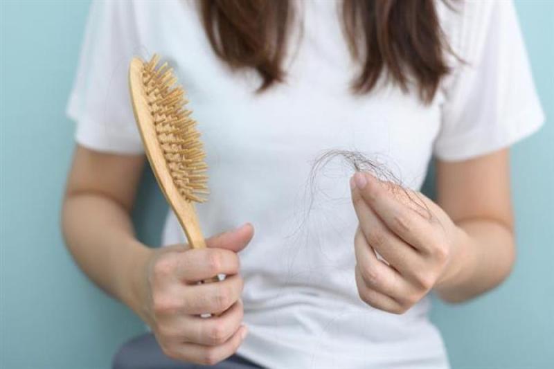 دراسة توضح علاقة ارتفاع مستويات الكوليسترول بتساقط الشعر