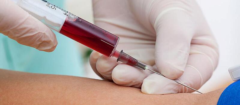 6 اختبارات دم مهمة لصحتك وكم مرة يجب إجراؤها