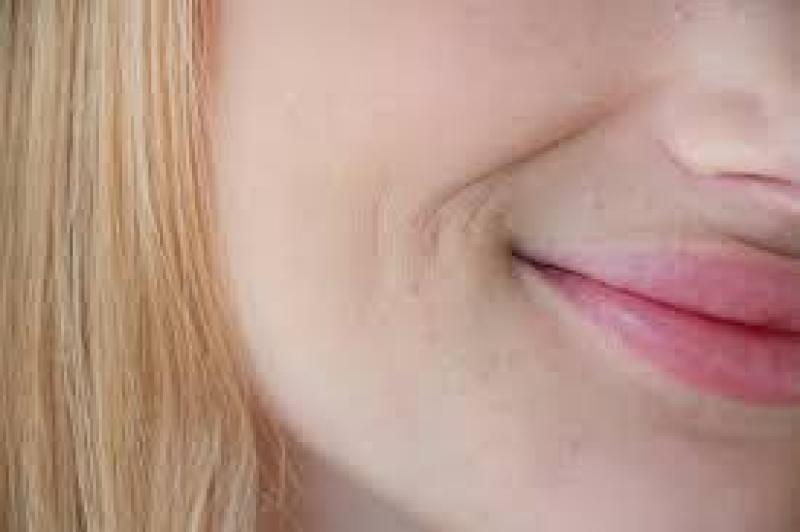 وصفات طبيعية لتفتيح منطقة حول الفم