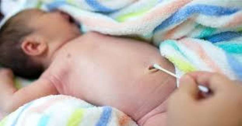 اعرف أسباب نزيف السرة عند الطفل حديث الولادة .. طبيب متخصص يوضح