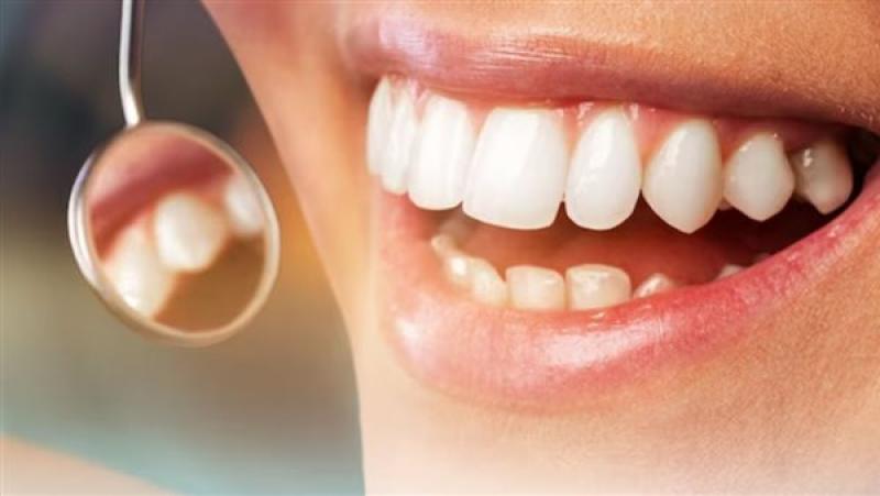 أسباب اصفرار الأسنان.. وكيفية التخلص منه