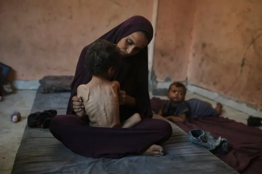 شهداء الجوع في غزة.. 5 وفيات بينهم طفلان نتيجة المجاعة وسوء التغذية