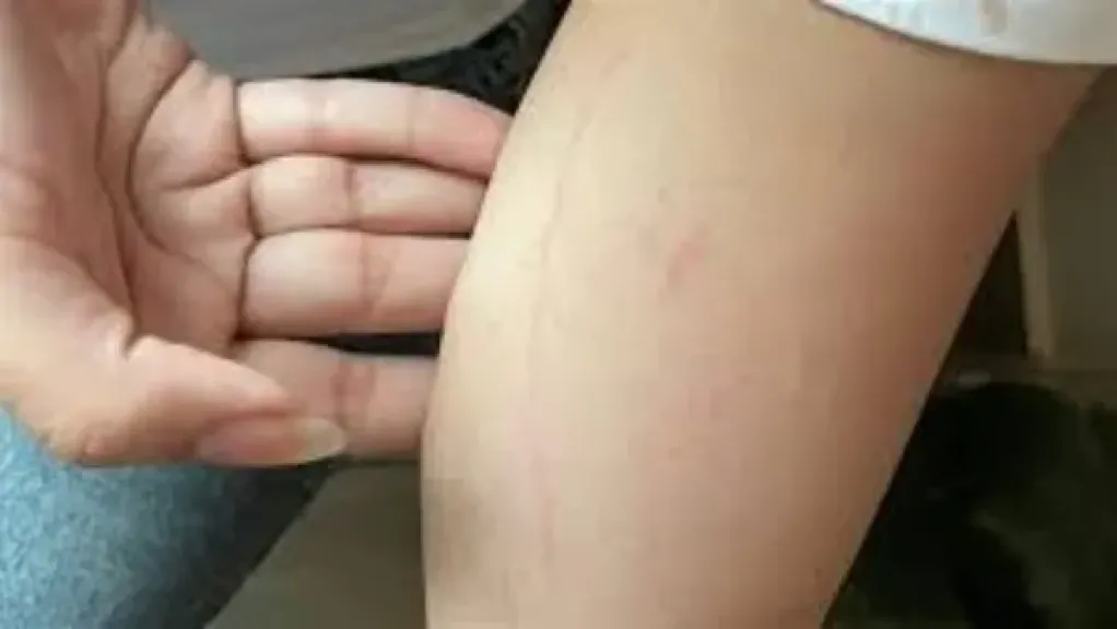 تنمروا على ابنتها لقصر قامتها.. سيدة تحرر محضرا ضد مسئولي مدرسة بالتجمع