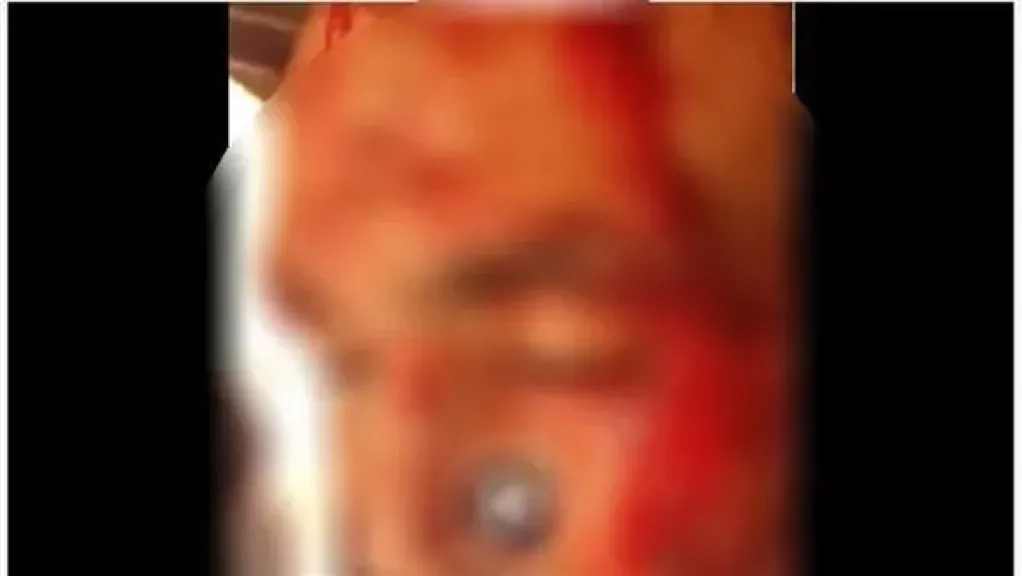 ضبط المتهمين بالتعدي على شخص لرفضه التنازل عن قضية بالدقهلية