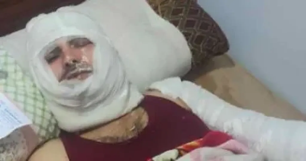 ضبط المتهمين بإشعال النيران فى شخص أمام زوجته وإصابته بحروق خطيرة