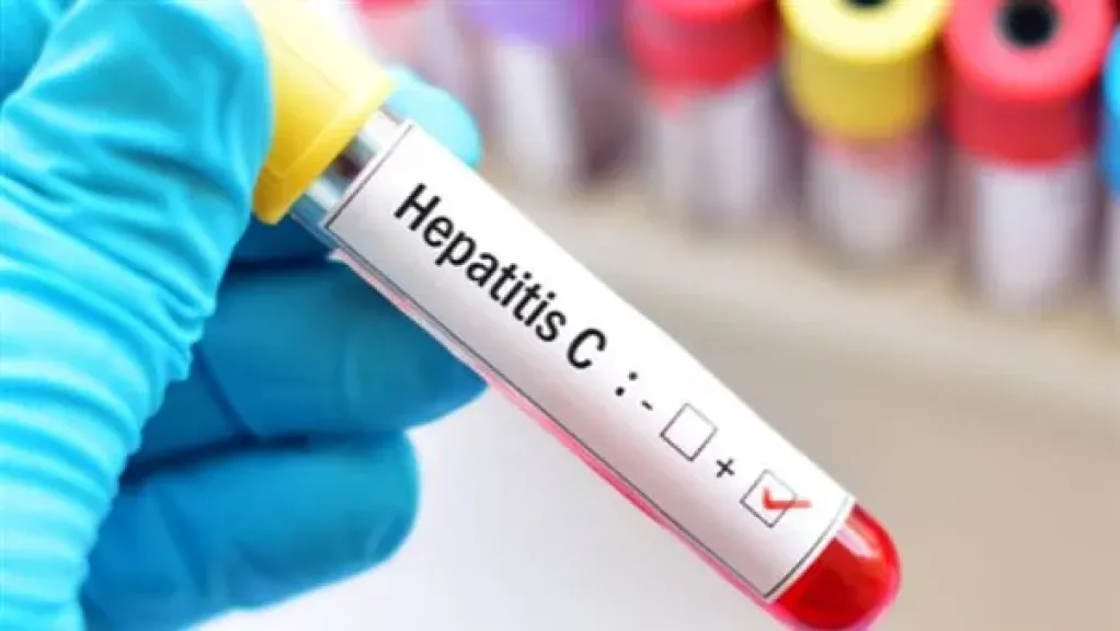 كيف نجحت مصر في القضاء على فيروس سي؟