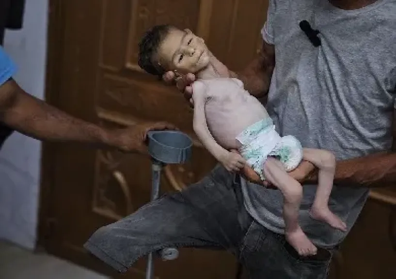 الأونروا: أطفال غزة يعيشون أوضاعا مزرية