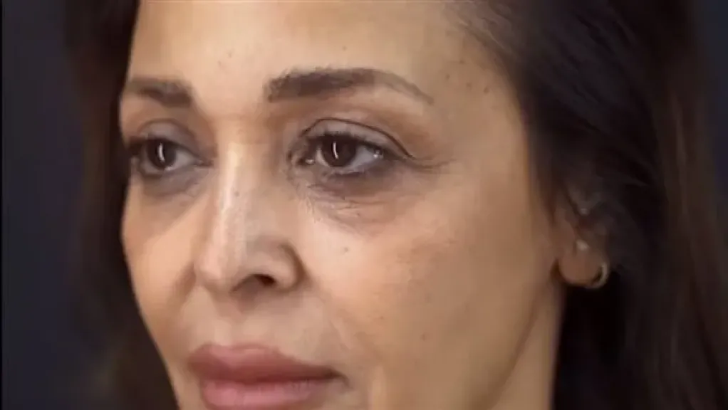 بعد شد الوجه والرقبة.. داليا البحيري تتحدث عن سر شبابها الجديد