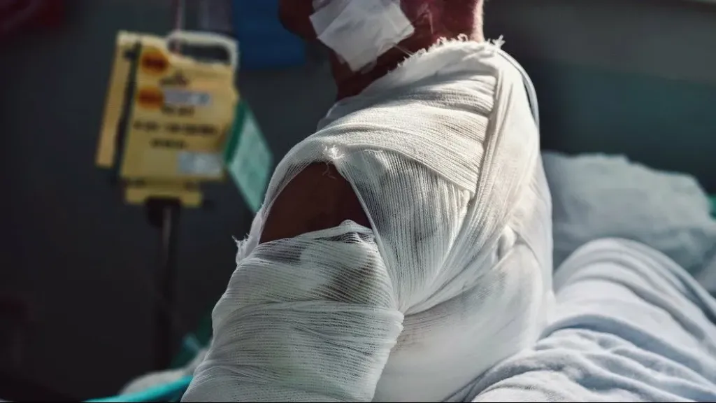 جراح تجميل: إنشاء بنك جلد قضية أمن قومي لعلاج مرضى الحروق