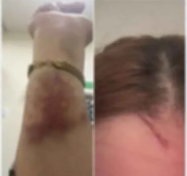 ضبط المتهمات بالتعدي على ممرضتين داخل مستشفى في بورسعيد