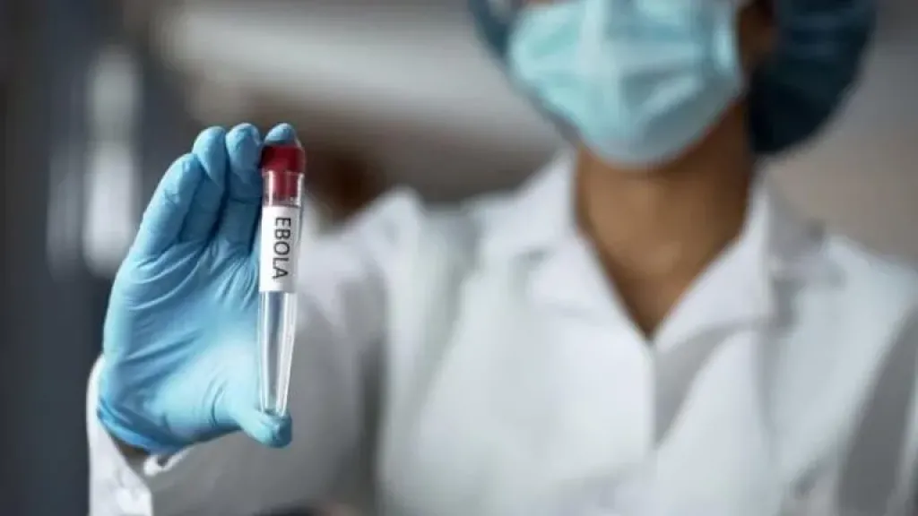 أستاذ أمراض صدرية يبعث برسالة طمأنة: إيبولا تحت السيطرة عالميًا ولا ينتشر بنفس سرعة كورونا