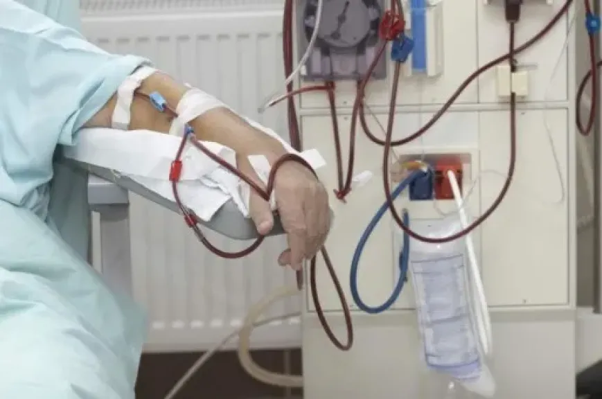 الصحة عن جلسات الغسيل الكلوي: «مينفعش المريض يجي في يوم ميلاقيش الخدمة متوفرة»