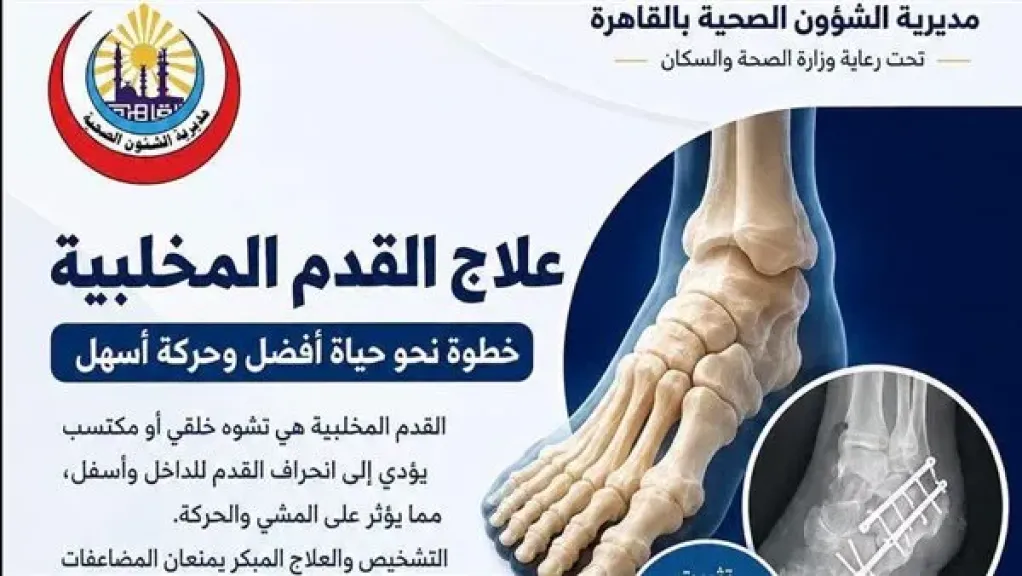 تدخل جراحي يصلح تشوه بالقدم المخلبية مع استعادة كفاءة الطرف السفلي